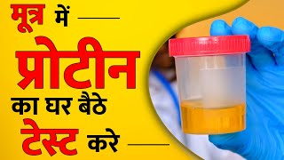 Home Test for Protein in Urine  यूरिन प्रोटीन टेस्ट घर पर कैसे करे [upl. by Lohrman]