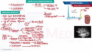 Hematología  Neoplasias mieloma multiple [upl. by Hestia]