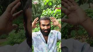 കിളിത്ത് 👦HAIR TRANSPLANT  Fun Da Malayalam Comedy Shorts [upl. by Yral]