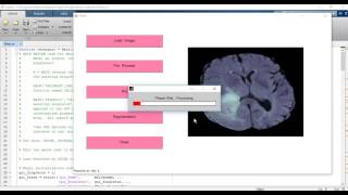 MRI brain tumor segmentation matlab code projects [upl. by Buttaro538]