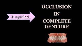 OCLUSION IN COMPLETE DENTURE  BALANCED OCCLUSION [upl. by Celinda]