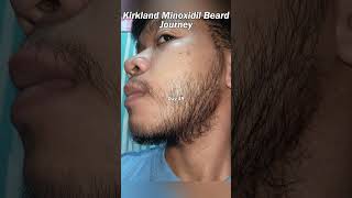 Kirkland Minoxidil Beard Journey 19 WEEK TRANSFORMATION [upl. by Cletus]