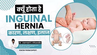 What is Inguinal Hernia Causes and Symptoms Treatment  बच्चों में अंडकोष हर्निया  लक्षण कारण [upl. by Ehpotsirhc543]