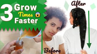 Rosemary For Hair Growth BEFORE AND AFTER RESULTS 😱 21 Days Using Rosemary  WORKS 🤔 [upl. by Ybor]