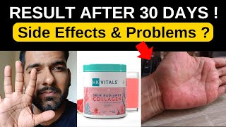 Results After 30 Days 😥  Side Effects amp Problems  How to Use Collagen [upl. by Laforge]