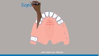 Biomecánica de la prótesis parcial removible la forma más fácil de entenderla [upl. by Lubbi]