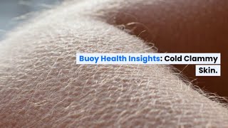 Cold Clammy Skin Common Causes and When to Seek Medical Care  BuoyHealthcom [upl. by Weisberg]