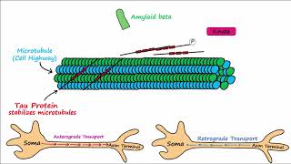 Alzheimers Disease  plaques tangles pathogenesis risk factors disease progression [upl. by Tamera]