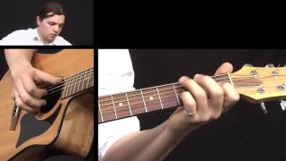 Caledonia Acoustic Guitar Lesson  Fingerstyle Guitar Lesson [upl. by Atinauq]