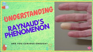 Raynauds Phenomenon  15 Things You Should Know [upl. by Renick272]