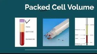 HCT Hematocrit Test PCV Packed cell Volume Test [upl. by Bullard]