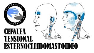 Dolor de cabeza masaje del musculo esternocleidomastoideo o ECM para la cefalea tensional [upl. by Llerrehs]