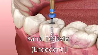 Kanal Tedavisi  Endodonti [upl. by Candy172]