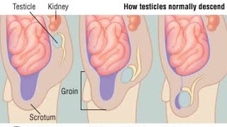 Testes descend Part 01  2nd Year MBBS OSPE Embryology [upl. by Lynnea]