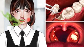 ASMR Dental Cleaning Procedures  Tonsil Stones Removal  Oral Health ASMR Dental Hygiene [upl. by Airotnes717]