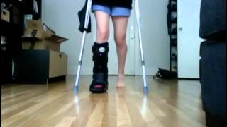 Walking After Ankle Surgery Days 1 amp 2 [upl. by Airret]