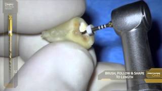 ProTaper Gold®  Dr West  Dentsply Sirona [upl. by Anirdnaxela]