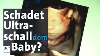 Babywatching Wie gefährlich ist 3DUltraschallUntersuchung in der Schwangerschaft für das Baby [upl. by Tirrag]