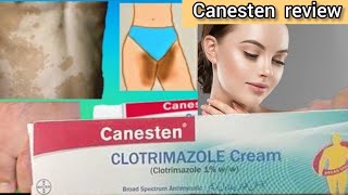 Canesten Cream clotrimazole 1  uses in urdu  Canesten Cream clotrimazole 1  side effects [upl. by Sellma]