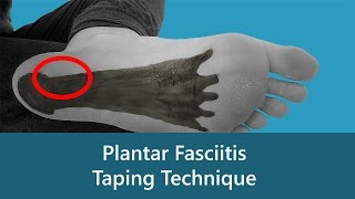 Plantar Fasciitis Taping Technique [upl. by Culliton85]