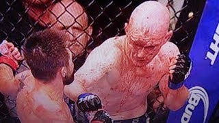 Sanchez vs Kampmann [upl. by Senecal]