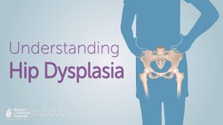 Understanding Hip Dysplasia  Boston Childrens Hospital [upl. by Troc667]