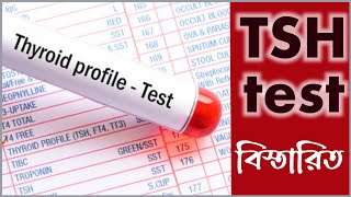 Tsh test report bangla  থাইরয়েড হরমোন টেস্ট খরচ কতো [upl. by Garvin]