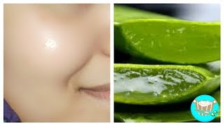 ✔️ Cómo hacer una mascarilla facial con sabila [upl. by Andreana]