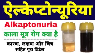 Alkaptonuria in hindi class 12 biology  black urine disease  ऐल्केप्टोन्यूरिया Biology ScienceSK [upl. by Conrado266]