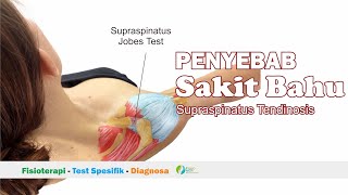 Pemeriksaan Bahu  Supraspinatus Jobes Test  Peradangan Otot Supraspinatus [upl. by Elane]