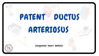 PATENT DUCTUS ARTERIOSUS  Causes  Symptoms  Pathophysiology  Treatment  The Nurses Station [upl. by Laurentium60]