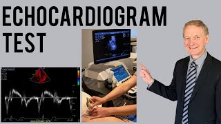 Echocardiogram Procedure  Heart Ultrasound  Everything you need to know [upl. by Hgielrahc]