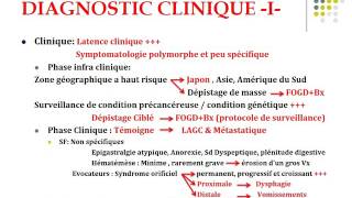 GASTROENTEROLOGIE Cancer de l estomac [upl. by Glynda]