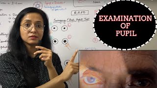 Examination Of Pupil  RAPD  Light Near Dissociation [upl. by Steffie]