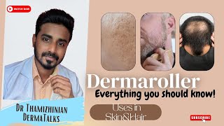 Dermaroller treatment  Dermaroller for hair growth  Dermaroller for acne scars dermaroller [upl. by Everara]