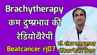 Brachytherapy Radiotherapy with less side effects कम दुस्प्रभाव वाली रेडियोथैरेपी [upl. by Andrew]