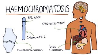 Understanding Haemochromatosis [upl. by Quincey307]