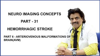 NEUROIMAGING CONCEPTS PART31PART 6HEMORRHAGIC STROKE ARTERIOVENOUS MALFORMATION OFTHE BRAINAVM [upl. by Sarge]