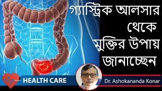 Peptic Ulcer Symptoms  কোন লক্ষণ গুলি হলে বুঝবেন গ্যাস্ট্রিক আলসার হয়েছে  Dr Ashokananda Konar [upl. by Ramas]