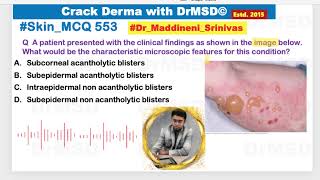 553 Subepidermal  Non acantholytic  Blistering disorders  Bullous pemphigoid  DrMSD  Cerebellum [upl. by Elletsyrc622]