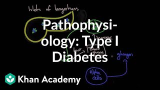 Pathophysiology  Type I diabetes  Endocrine system diseases  NCLEXRN  Khan Academy [upl. by Goulette829]