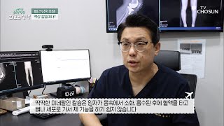 혈액에 즉각 흡수되는 빠른 뼈🦴 형성 도우미 ❝액상 칼슘❞ TV CHOSUN 20220430 방송  글로벌 힐링 최고의 선택 44회  TV조선 [upl. by Yerag379]