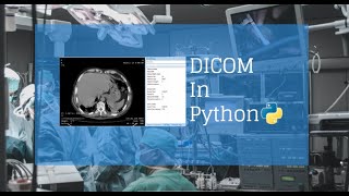 3 Dicom files to Image [upl. by Lucina]