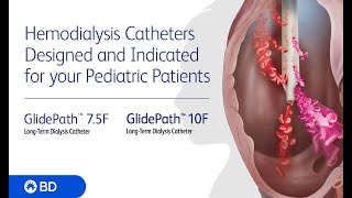 BD GlidePath™ 75F and 10F LongTerm Hemodialysis Catheter Procedural Animation no audio [upl. by Kary]