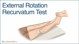 External Rotation Recurvatum Test [upl. by Euqinay]