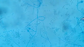 Penicillium growth and its structures under the microscope [upl. by Andie59]