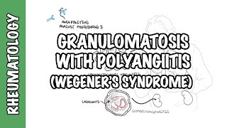 Granulomatosis with Polyangiitis pathophysiology symptoms treatment [upl. by Darlene269]