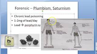 Forensic 260 a Plumbism Saturnism Chronic lead poisoning Burton Burtonian line Basophilic stippling [upl. by Fallon]