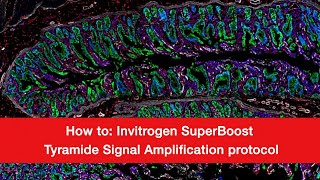 How to Invitrogen SuperBoost Tyramide Signal Amplification Protocol [upl. by Ellehcirt]