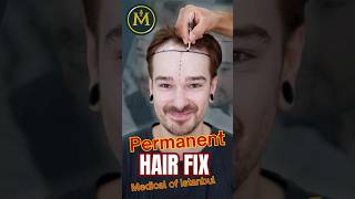 Hairline renewal treatment  Medical of Istanbul [upl. by Mailliwnhoj29]